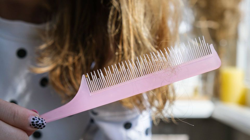 Хватит прятать залысины под платком: с выпадением волос надо бороться так