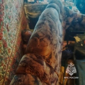 Мужчина вызвал спасателей, потому что его ногу чуть не &quot;съел&quot; диван