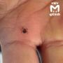 Клещи вернулись в Татарстан вместе с солнышком