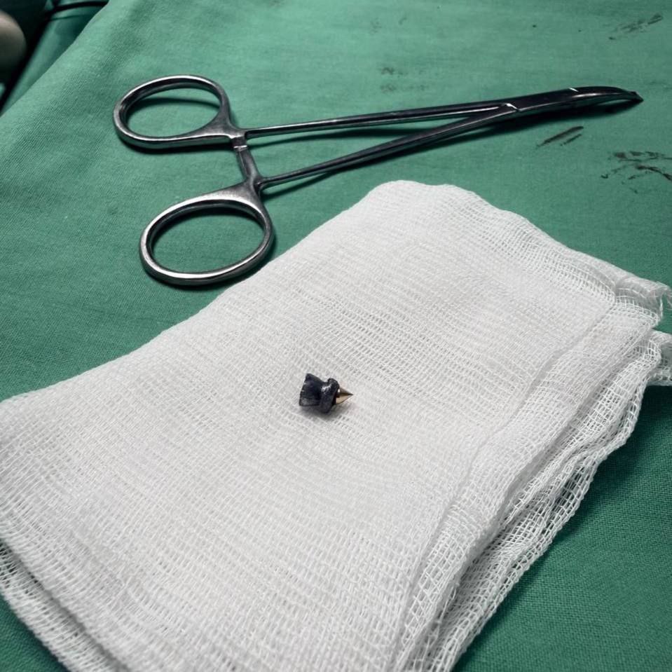 Парень случайно выстрелил себе в шею из пневмата Парень случайно выстрелил себе в шею из пневмата