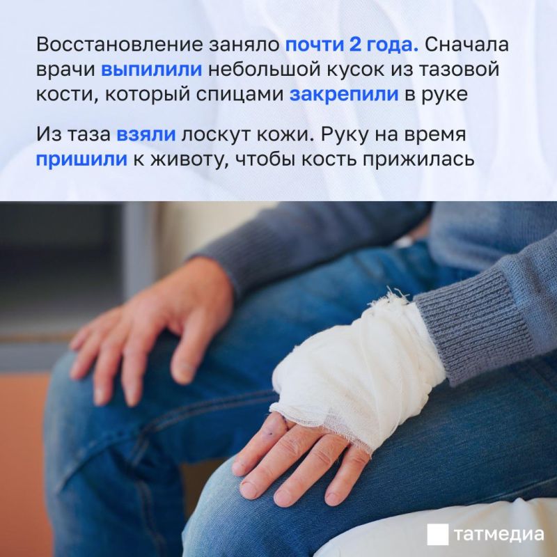 «Собрали из его же кожи и кости»: медики воссоздали мужчине палец «Собрали из его же кожи и кости»: медики воссоздали мужчине палец