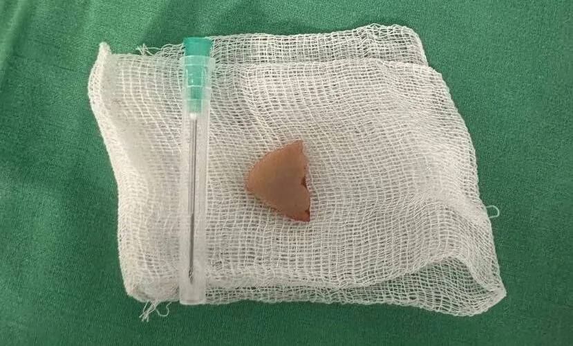 � ���������� ����� ������� �� ������ �������� ������� �����