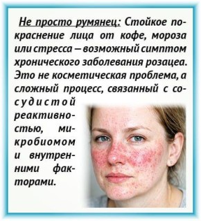 ����� ������� ����� ���������� ��� ��������?