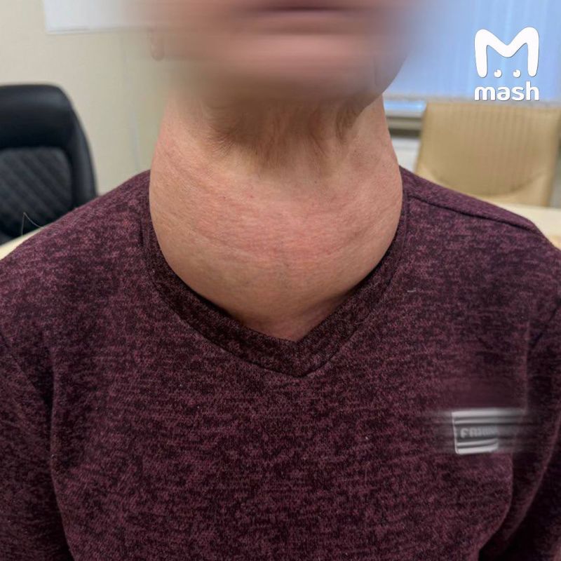 ������� ��������� �������� � ������ ������� � ����������� �� ���������� � ��� 40 ��� �� ����� �������� �� ��������