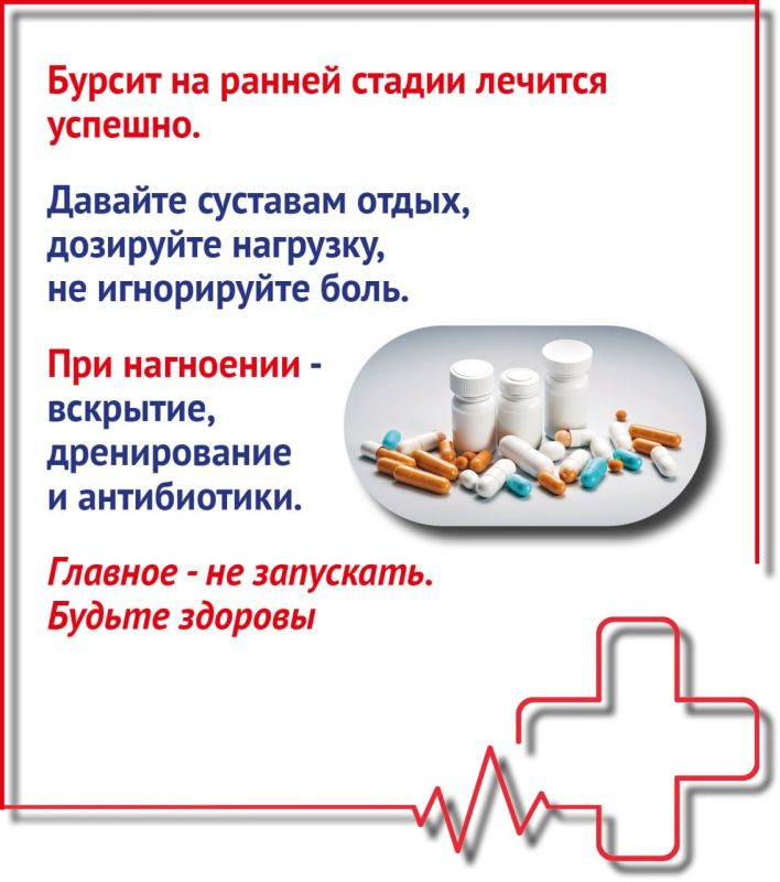Что такое бурсит и как его лечить Что такое бурсит и как его лечить