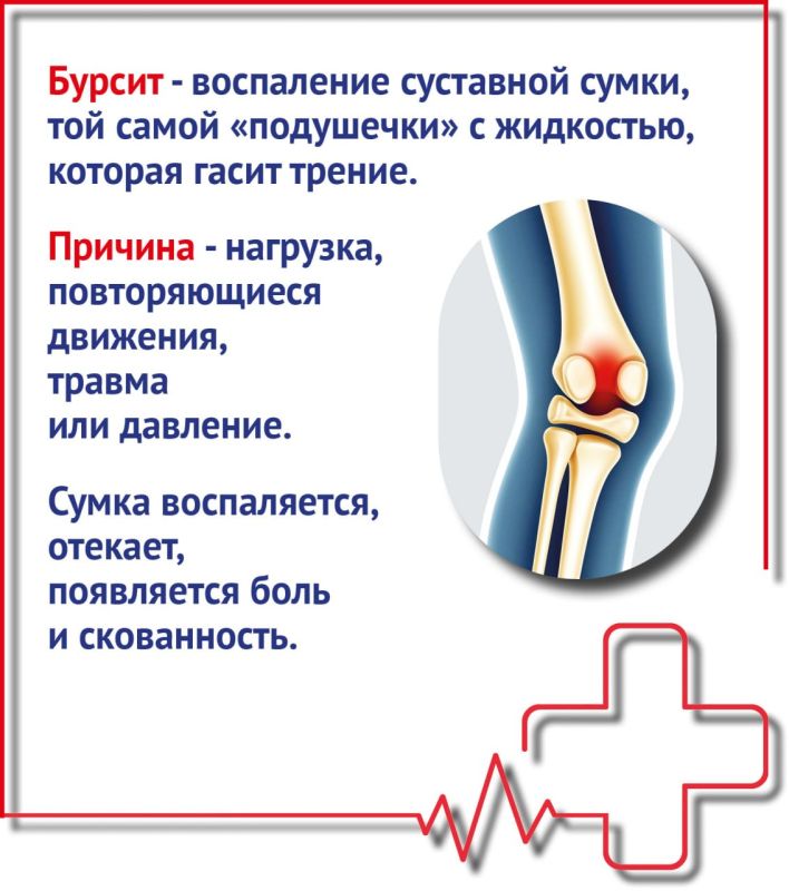 Что такое бурсит и как его лечить Что такое бурсит и как его лечить