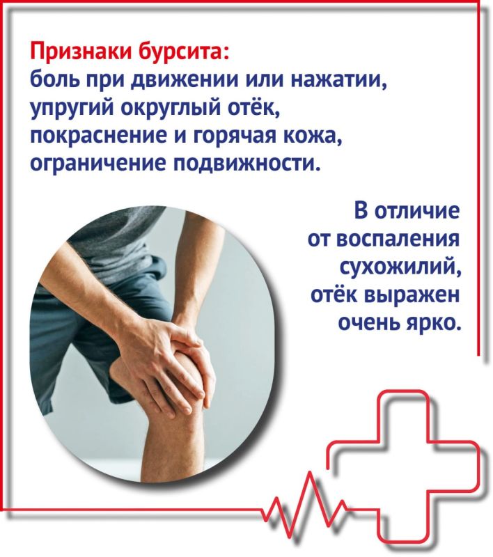 Что такое бурсит и как его лечить Что такое бурсит и как его лечить