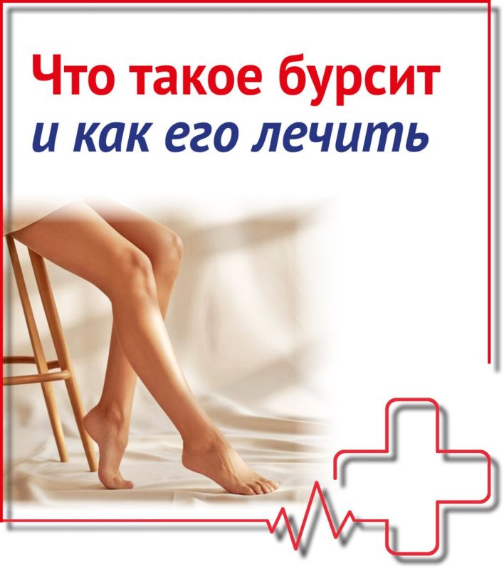 Что такое бурсит и как его лечить