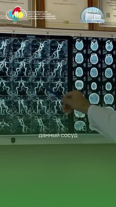 «Каждую минуту погибает миллион нервных клеток»: почему при инсульте нельзя ждать