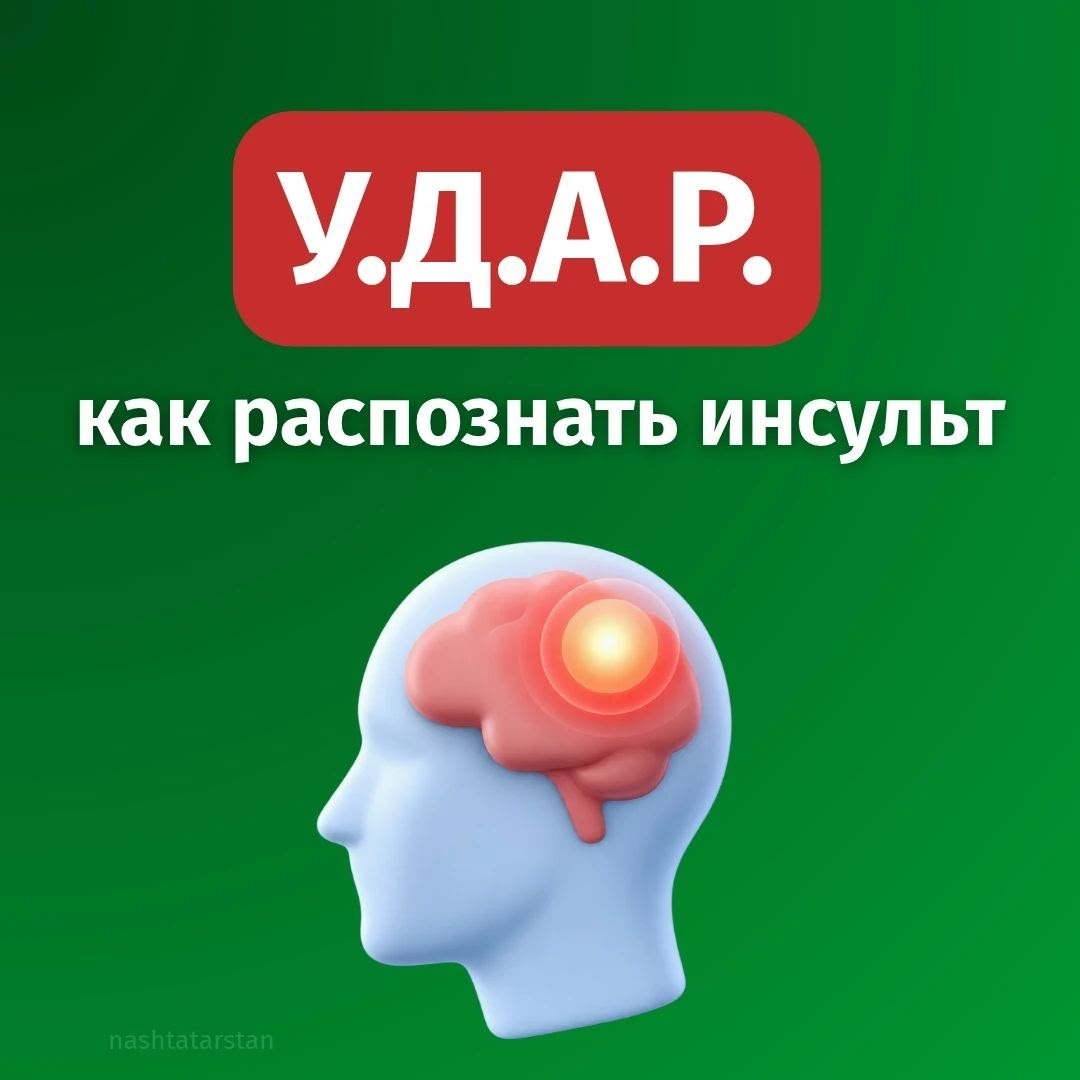 29 октября – Всемирный день борьбы с инсультом